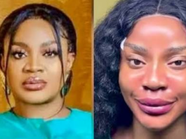 Actress Uche Ogbodo Laments New Look After Artificial Face Procedure