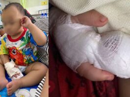 Horror As Nurse Accidentally Cuts Off Baby’s Finger With Scissors While Discharging Him After Treatment